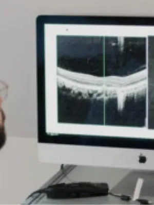  Pièges diagnostiques dans la DMLA 