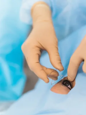  Chirurgie de l’oeil 