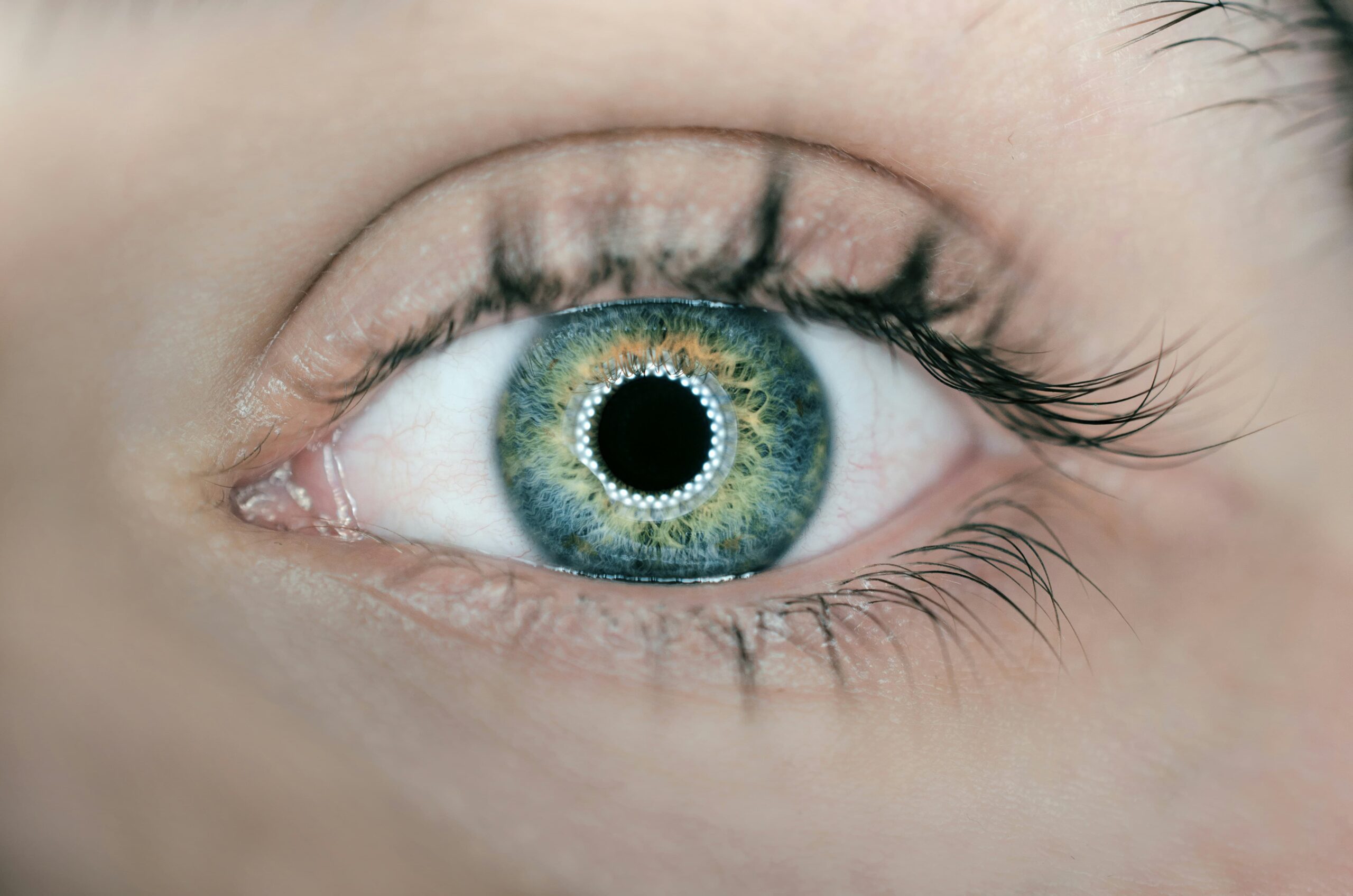 zoom sur un oeil et sa paupière pour illustrer la chirurgie des paupières